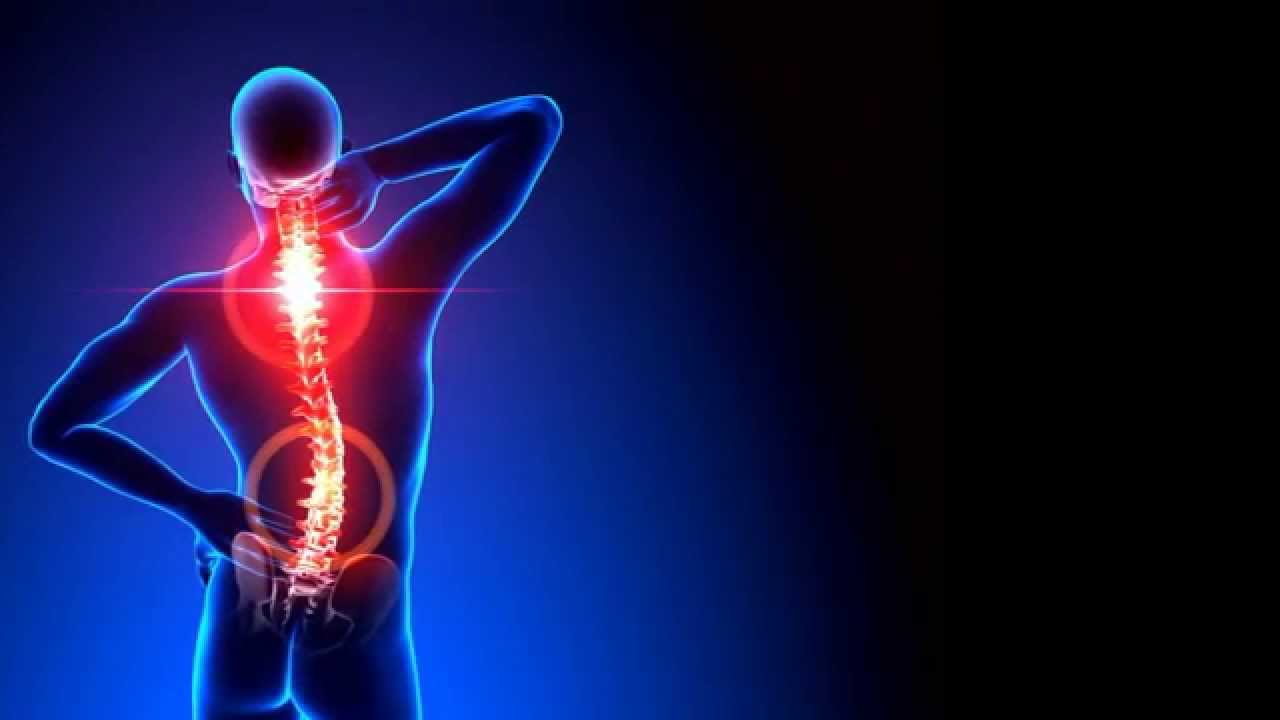 Présentation du troubles musculo-squelettiques